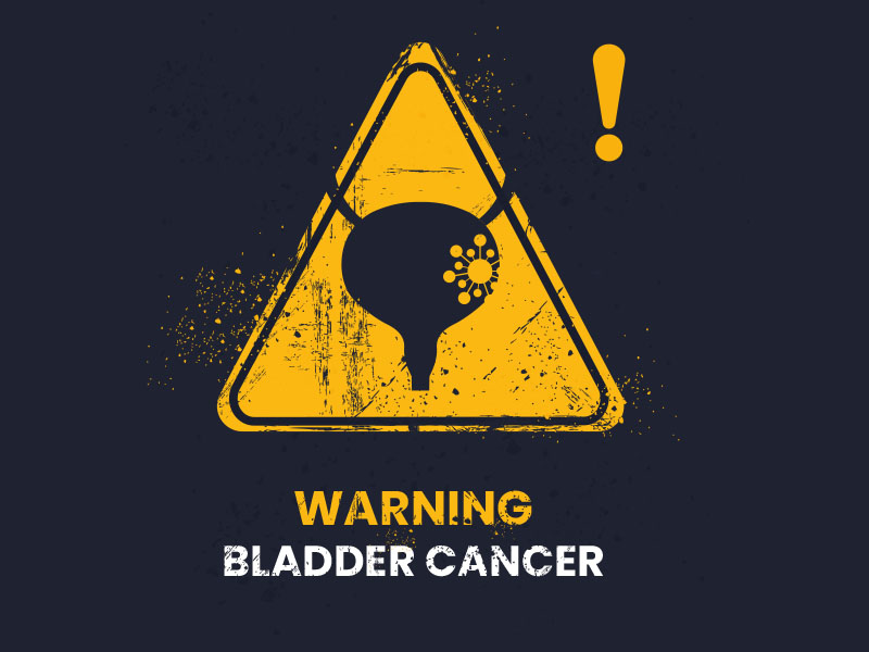 Muscle Invasive Bladder Cancer: Why Early Detection Matters | Dr. Nitin Bayas Explains